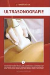Ultrasonografie